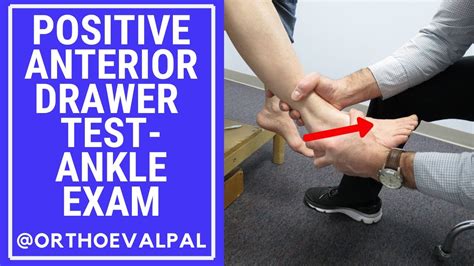 potts compression test|anterior drawer test ankle positive.